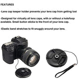 Canon EOS 90D DSLR Camera and Canon EF-S 18-55mm f/3.5-5.6 is STM Lens & Professional Accessory Bundle W/ 2X 32GB Memory Cards + Case & Wide Angle & Telephoto Lens + More!